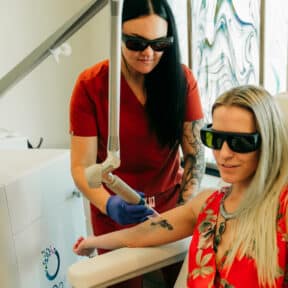 Laser Tattoo Removal