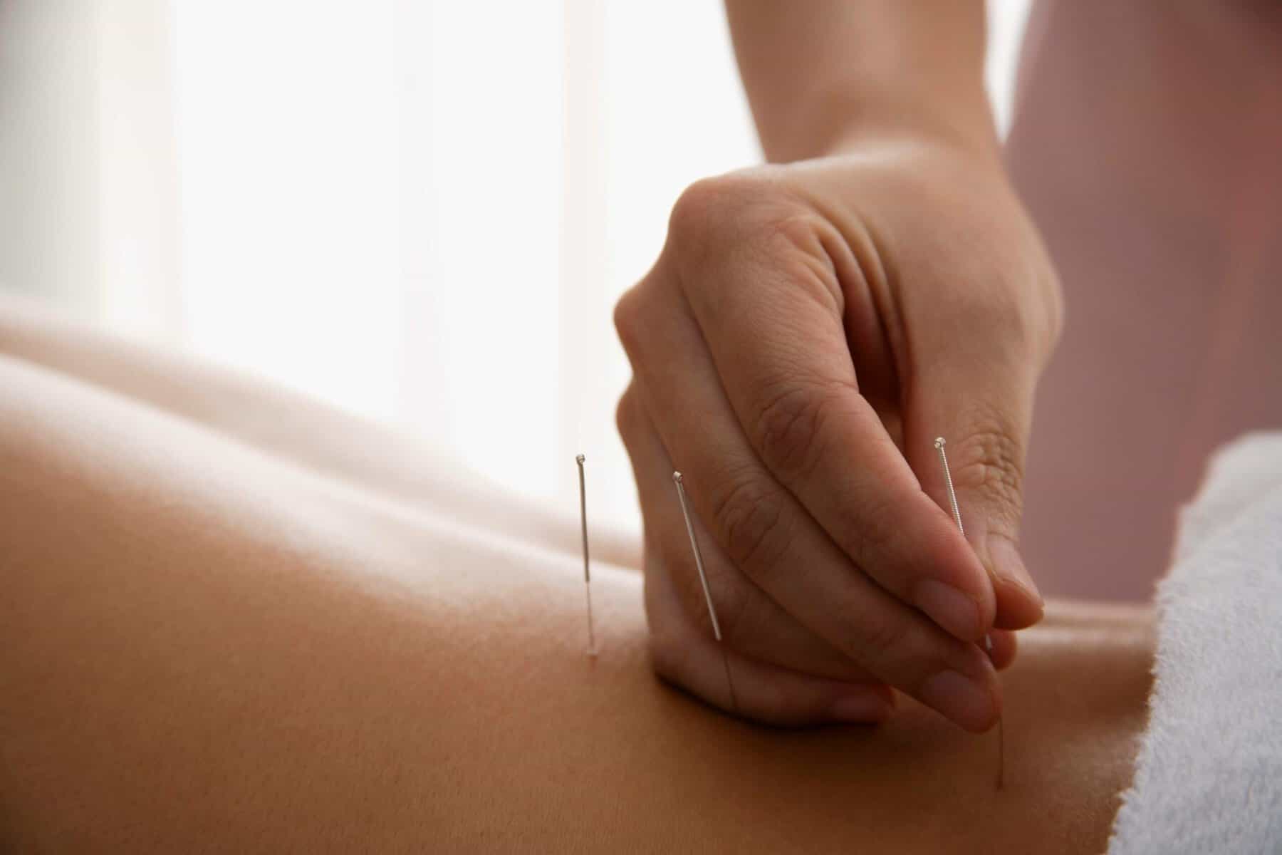massage therapy